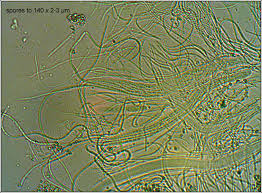 Attēlu rezultāti vaicājumam “Stictis”