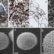 Attēlu rezultāti vaicājumam “Comatricha pulchella spores”