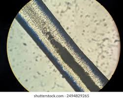 Image result for human hair microscope image