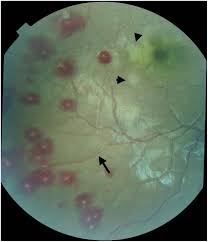 Attēlu rezultāti vaicājumam “Reticularia lobata plasmodium”