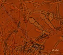 Attēlu rezultāti vaicājumam “Erysiphe galeopsidis”