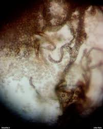 Attēlu rezultāti vaicājumam “Lycogala cf. fossiculatum”