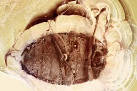 Attēlu rezultāti vaicājumam “Hylastes sp.”