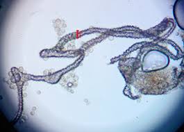 Attēlu rezultāti vaicājumam “Lycogala roseosporum sessile”