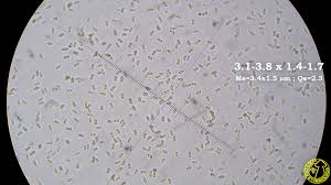 Attēlu rezultāti vaicājumam “Pseudomerulius aureus”