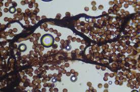 Attēlu rezultāti vaicājumam “Amaurochaete atra spores”