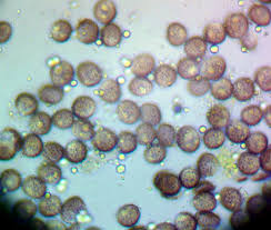 Attēlu rezultāti vaicājumam “Fuligo gyrosa spores”