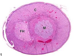 Attēlu rezultāti vaicājumam “Perichaena corticalis sessile”