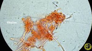 Attēlu rezultāti vaicājumam “Postia fragilis”