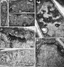 Attēlu rezultāti vaicājumam “Orbilia sp.”