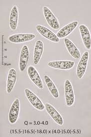 Attēlu rezultāti vaicājumam “Hymenoscyphus calyculus”