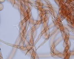 Attēlu rezultāti vaicājumam “Metatrichia floriformis stalked”