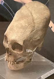 Image result for elongated skulls