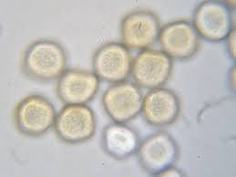 Attēlu rezultāti vaicājumam “Tranzschelia anemones”