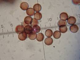 Attēlu rezultāti vaicājumam “Stemonitopsis aequalis var. microspora spores”