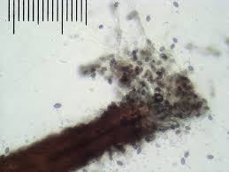 Attēlu rezultāti vaicājumam “Melanospora lagenaria”