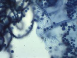 Attēlu rezultāti vaicājumam “Heterotrichia obvelata (syn. Arcyria obvelata) spores”