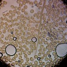 Attēlu rezultāti vaicājumam “Trichiaceae, Hemitrichiaceae, Arcyriaceae”