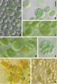 Attēlu rezultāti vaicājumam “Nostoc commune cells”