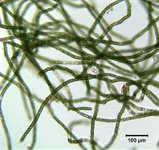Attēlu rezultāti vaicājumam “Comatricha elegans var. microspora spores”