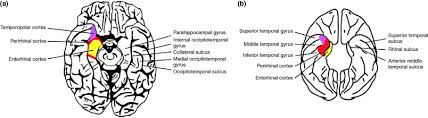 Attēlu rezultāti vaicājumam “Perichaena corticalis sessile”