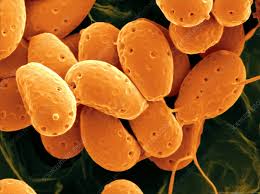 Attēlu rezultāti vaicājumam “Diderma radiatum spores”