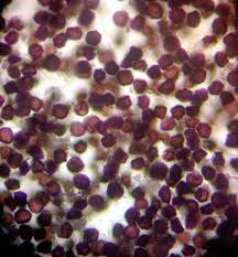 Attēlu rezultāti vaicājumam “Didymium spongiosum var. dictyospora”