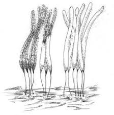 Attēlu rezultāti vaicājumam “Arcyria minuta stalked”