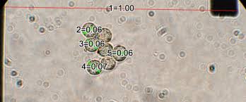 Attēlu rezultāti vaicājumam “Lindbladia tubulina spores”