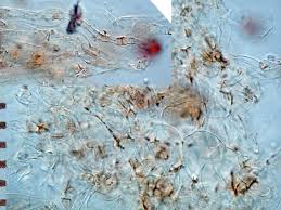 Attēlu rezultāti vaicājumam “Pachyphloeus melanoxanthus”