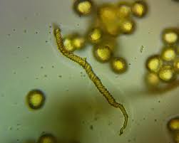 Attēlu rezultāti vaicājumam “Trichia contorta”