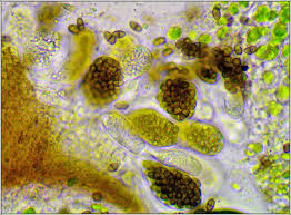 Attēlu rezultāti vaicājumam “Licea pygmaea spores”