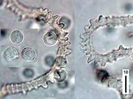 Attēlu rezultāti vaicājumam “Arcyria incarnata”