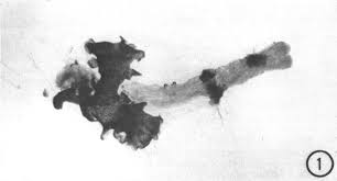 Attēlu rezultāti vaicājumam “Blasia pusilla sporophyte”