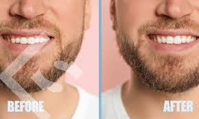 Bildergebnis für smile