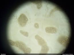 Attēlu rezultāti vaicājumam “Lycogala sphaeroconicum macro”