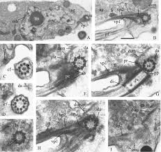 Attēlu rezultāti vaicājumam “Symphytocarpus impexus plasmodium”