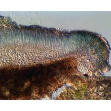 Attēlu rezultāti vaicājumam “Lecidella elaeochroma”