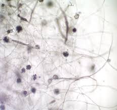 Attēlu rezultāti vaicājumam “Seligeria donniana sporophyte”