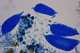 Attēlu rezultāti vaicājumam “Phlyctis agelaea”