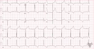 Image result for  ^ L V [ h    