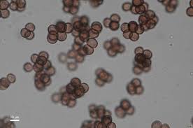 Attēlu rezultāti vaicājumam “Badhamia lilacina spores”