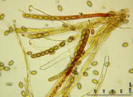 Attēlu rezultāti vaicājumam “Sowerbyella radiculata”