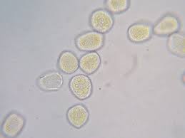 Attēlu rezultāti vaicājumam “Melampsora magnusiana”