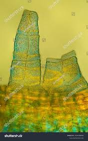 Attēlu rezultāti vaicājumam “Orthotrichum anomalum sporophyte”