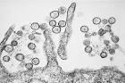 <b>Hantavirus</b>