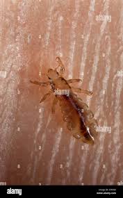 Attēlu rezultāti vaicājumam “Pediculus humanus capitis”