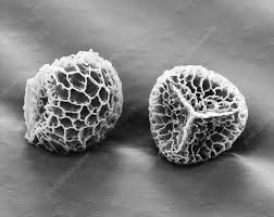 Attēlu rezultāti vaicājumam “Lignydium muscorum spores”