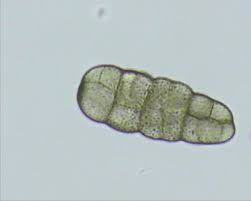 Attēlu rezultāti vaicājumam “Stemonitopsis aequalis var. microspora”