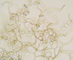 Attēlu rezultāti vaicājumam “Arcyria globosa”